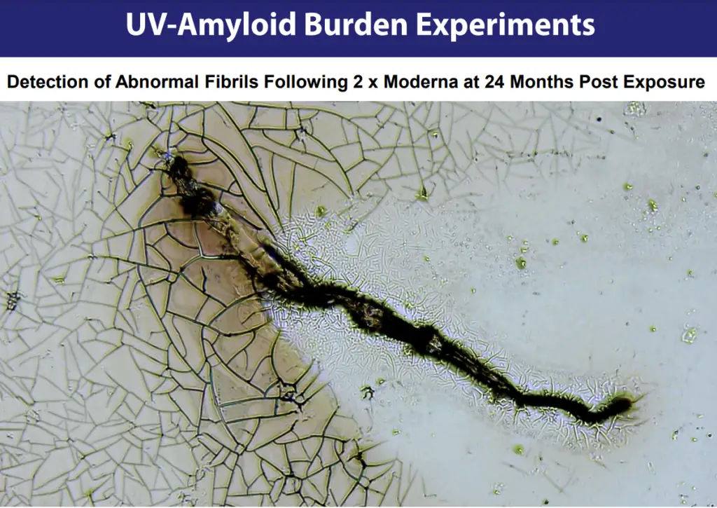 Amyloid Burden Exp. 1